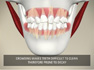 Orthodontic Problems